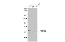 Anti-TOM1L2 antibody [C3], C-term used in Western Blot (WB). GTX106295