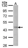 Anti-DYX1C1 antibody [C3], C-term used in Western Blot (WB). GTX106296