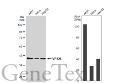 Anti-VPS26 antibody [C2C3], C-term used in Western Blot (WB). GTX106297