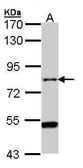 Anti-AGAP1 antibody [C3], C-term used in Western Blot (WB). GTX106298