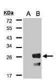 Anti-RGS19 antibody [C2C3], C-term used in Western Blot (WB). GTX106302