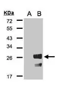 Anti-RGS19 antibody [C2C3], C-term used in Western Blot (WB). GTX106302