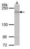 Anti-ARAP1 antibody [C3], C-term used in Western Blot (WB). GTX106303