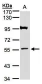 Anti-ADAMTSL1 antibody [N2], N-term used in Western Blot (WB). GTX106304