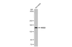 Anti-NSD2 antibody [N1], N-term used in Western Blot (WB). GTX106306