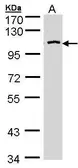 Anti-CENTG3 antibody [C3], C-term used in Western Blot (WB). GTX106308