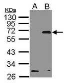 Anti-NET1 antibody [C3], C-term used in Western Blot (WB). GTX106310