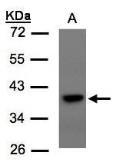 Anti-TCF19 antibody used in Western Blot (WB). GTX106311