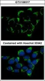 Anti-CMG1 antibody [C3], C-term used in Immunocytochemistry/ Immunofluorescence (ICC/IF). GTX106317