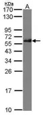 Anti-CMG1 antibody [C3], C-term used in Western Blot (WB). GTX106317