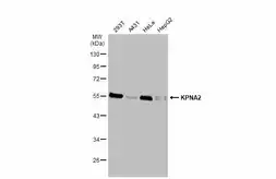 Anti-KPNA2 antibody [C3], C-term used in Western Blot (WB). GTX106323