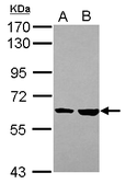 Anti-KPNA4 antibody [C3], C-term used in Western Blot (WB). GTX106325