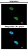 Anti-CBP80 antibody [N2], N-term used in Immunocytochemistry/ Immunofluorescence (ICC/IF). GTX106328