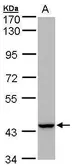 Anti-PEX13 antibody [C3], C-term used in Western Blot (WB). GTX106330