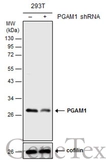 Anti-PGAM1 antibody [C2C3], C-term used in Western Blot (WB). GTX106331