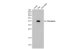 Anti-Pleckstrin antibody [C2C3], C-term used in Western Blot (WB). GTX106332