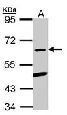 Anti-PLRG1 antibody [C3], C-term used in Western Blot (WB). GTX106333