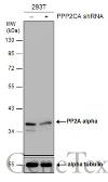 Anti-PP2A alpha antibody used in Western Blot (WB). GTX106334
