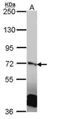 Anti-RanGAP1 antibody [N1], N-term used in Western Blot (WB). GTX106338