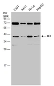 Anti-SET antibody, isoform 2-specific used in Western Blot (WB). GTX106342