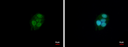 Anti-BAF57 antibody [C3], C-term used in Immunocytochemistry/ Immunofluorescence (ICC/IF). GTX106345