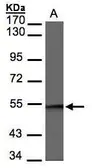 Anti-BAF57 antibody [C3], C-term used in Western Blot (WB). GTX106345