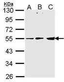 Anti-PDHX antibody [C3], C-term used in Western Blot (WB). GTX106352