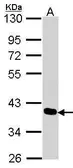 Anti-PDLIM4 antibody [C2C3], C-term used in Western Blot (WB). GTX106353