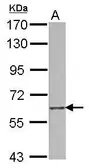 Anti-SCARF1 antibody used in Western Blot (WB). GTX106354