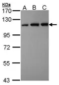 Anti-VDP / p115 antibody [C3], C-term used in Western Blot (WB). GTX106355