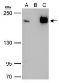 Anti-TAF172 antibody [C3], C-term used in Immunoprecipitation (IP). GTX106359