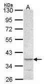 Anti-PSCDBP antibody [N1], N-term used in Western Blot (WB). GTX106363