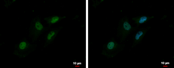 Anti-MTA2 antibody [C3], C-term used in Immunocytochemistry/ Immunofluorescence (ICC/IF). GTX106367