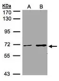 Anti-CDYL antibody used in Western Blot (WB). GTX106369