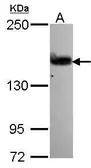 Anti-ARHGEF5 antibody [N2], N-term used in Western Blot (WB). GTX106374