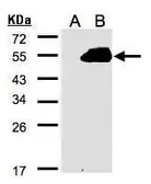 Anti-PAMCI antibody [C3], C-term used in Western Blot (WB). GTX106375