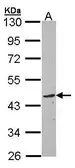 Anti-TOM1L1 antibody [C3], C-term used in Western Blot (WB). GTX106377