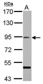 Anti-RanBP9 antibody used in Western Blot (WB). GTX106378