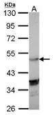 Anti-LXR alpha antibody [C3], C-term used in Western Blot (WB). GTX106380