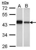 Anti-GIPC1 antibody used in Western Blot (WB). GTX106382