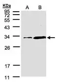 Anti-PITPN antibody [C2C3], C-term used in Western Blot (WB). GTX106397