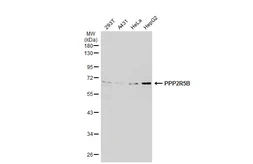 Anti-PPP2R5B antibody [C3], C-term used in Western Blot (WB). GTX106400