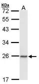 Anti-CBX1 / HP1 beta antibody used in Western Blot (WB). GTX106418