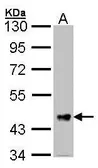 Anti-FSTL1 antibody [C2C3], C-term used in Western Blot (WB). GTX106425