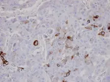 Anti-AKAP10 antibody [C3], C-term used in IHC (Paraffin sections) (IHC-P). GTX106430
