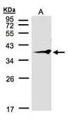 Anti-RNF2 antibody [C2C3], C-term used in Western Blot (WB). GTX106431