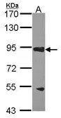 Anti-RASA3 antibody [C3], C-term used in Western Blot (WB). GTX106437