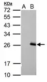 Anti-RGS17 antibody [C2C3], C-term used in Western Blot (WB). GTX106449
