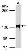Anti-SAP130 antibody [C3], C-term used in Western Blot (WB). GTX106450