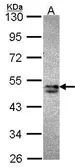 Anti-SNX15 antibody [C2C3], C-term used in Western Blot (WB). GTX106453